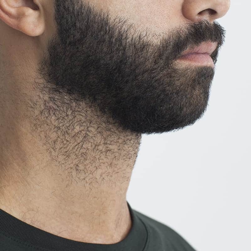 sunrise-chin-sensor-sleep-apnoea-test-beards sunrise-chin-sensor-sleep-apnoea-test-beards